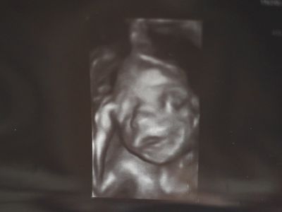 24W妊娠7ヶ月の超音波4D写真
